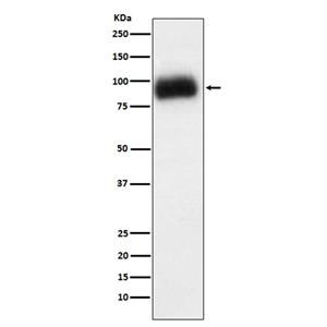 ADAM15 (11M11)兔单抗,ADAM15 (11M11) Rabbit Monoclonal Antibody