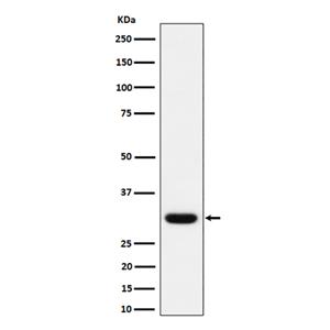 Adiponectin (5N3)兔单抗,Adiponectin (5N3) Rabbit Monoclonal Antibody