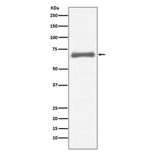 AFP (1J18)兔单抗,AFP (1J18) Rabbit Monoclonal Antibody
