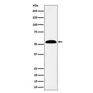 ALDH7A1 (14K11)兔单抗,ALDH7A1 (14K11) Rabbit Monoclonal Antibody
