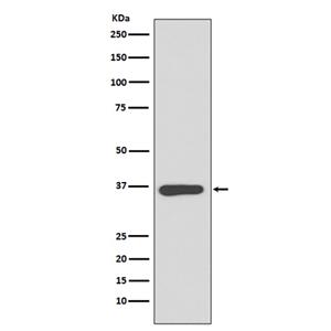 Annexin A10 (14O15)兔单抗,Annexin A10 (14O15) Rabbit Monoclonal Antibody