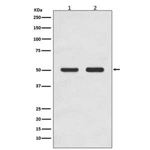 AP2M1 (5T7)兔单抗,AP2M1 (5T7) Rabbit Monoclonal Antibody