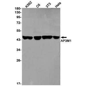 AP3M1 (16F4)兔单抗,AP3M1 (16F4) Rabbit Monoclonal Antibody