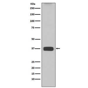 ARG1 (7H3)兔单抗,ARG1 (7H3) Rabbit Monoclonal Antibody