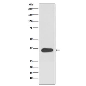 ATF1 (6N1)兔单抗,ATF1 (6N1) Rabbit Monoclonal Antibody