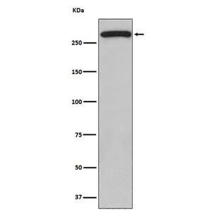 ATM (2G7)兔单抗,ATM (2G7) Rabbit Monoclonal Antibody