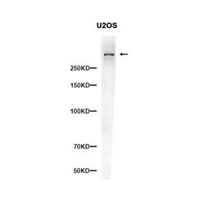ATM (2G7)兔单抗,ATM (2G7) Rabbit Monoclonal Antibody