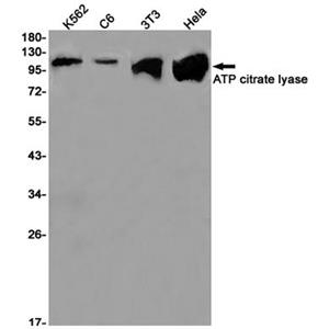 ATP citrate lyase  (8L17)兔单抗,ATP citrate lyase  (8L17) Rabbit Monoclonal Antibody