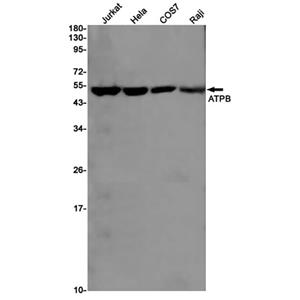 ATPB (19W10)兔单抗,ATPB (19W10) Rabbit Monoclonal Antibody