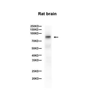 B Raf (9L5)兔单抗,B Raf (9L5) Rabbit Monoclonal Antibody