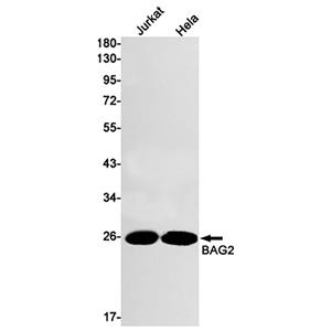 BAG2 (9Z17)兔单抗,BAG2 (9Z17) Rabbit Monoclonal Antibody
