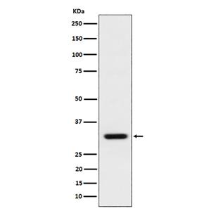 BCL2L12 (18T13)兔单抗,BCL2L12 (18T13) Rabbit Monoclonal Antibody