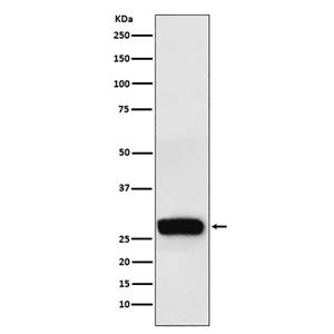 beta Casein (1J13)兔单抗,beta Casein (1J13) Rabbit Monoclonal Antibody