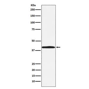 BGAT (19J2)兔单抗,BGAT (19J2) Rabbit Monoclonal Antibody