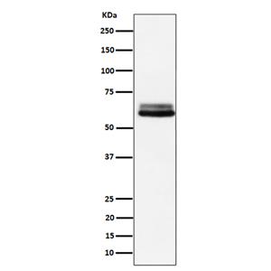BIN1 (14G10)兔单抗,BIN1 (14G10) Rabbit Monoclonal Antibody