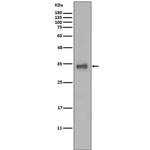 Calponin  (6N15)兔单抗,Calponin  (6N15) Rabbit Monoclonal Antibody