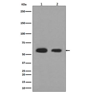 Calreticulin (3B4)兔单抗,Calreticulin (3B4) Rabbit Monoclonal Antibody