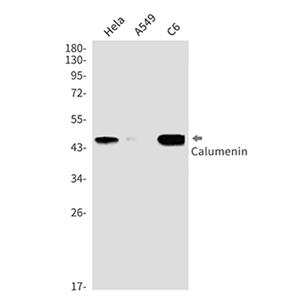 Calumenin (14E19)兔单抗,Calumenin (14E19) Rabbit Monoclonal Antibody