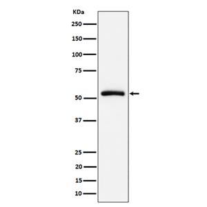 CAP1 (14W1)兔单抗,CAP1 (14W1) Rabbit Monoclonal Antibody