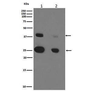 Cathepsin D (11F19)兔单抗,Cathepsin D (11F19) Rabbit Monoclonal Antibody