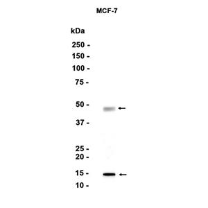 Cathepsin D (11F19)兔单抗,Cathepsin D (11F19) Rabbit Monoclonal Antibody
