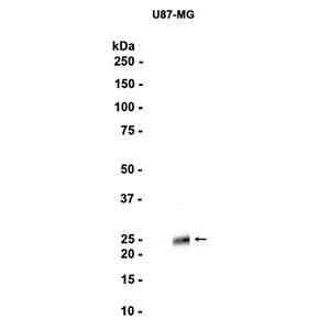 Cathepsin S (16H3)兔单抗,Cathepsin S (16H3) Rabbit Monoclonal Antibody
