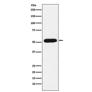 CBX4 (10P4)兔单抗,CBX4 (10P4) Rabbit Monoclonal Antibody