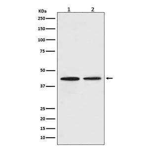 CCR9 (11E6)兔单抗,CCR9 (11E6) Rabbit Monoclonal Antibody
