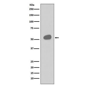 CD14 (16H16)兔单抗,CD14 (16H16) Rabbit Monoclonal Antibody