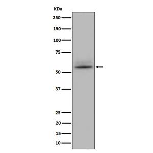 CD147 (8C17)兔单抗,CD147 (8C17) Rabbit Monoclonal Antibody