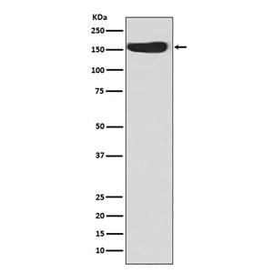 CD163 (1O3)兔单抗,CD163 (1O3) Rabbit Monoclonal Antibody