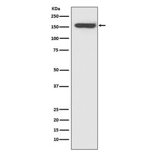 CD21 (14S6)兔单抗,CD21 (14S6) Rabbit Monoclonal Antibody