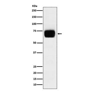 CD33 (18N8)兔单抗,CD33 (18N8) Rabbit Monoclonal Antibody