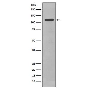 CD34 (7Z7)兔单抗,CD34 (7Z7) Rabbit Monoclonal Antibody