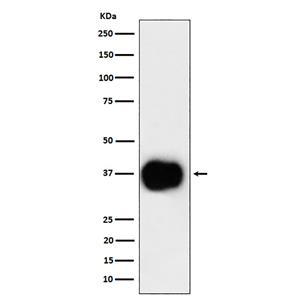CD79b (1O8)兔单抗,CD79b (1O8) Rabbit Monoclonal Antibody