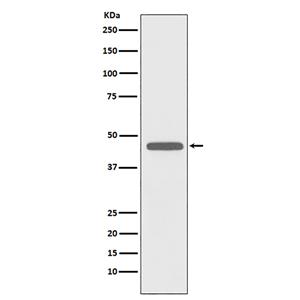 CD83 (7K14)兔单抗,CD83 (7K14) Rabbit Monoclonal Antibody