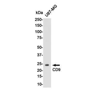 CD9 (17X5)兔单抗,CD9 (17X5) Rabbit Monoclonal Antibody