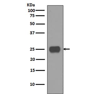 CD90 / Thy1 (2D12)兔单抗,CD90 / Thy1 (2D12) Rabbit Monoclonal Antibody