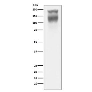 CEA(CD66e) (7M6)兔单抗,CEA(CD66e) (7M6) Rabbit Monoclonal Antibody