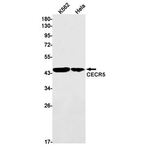 CECR5 (17M19)兔单抗,CECR5 (17M19) Rabbit Monoclonal Antibody