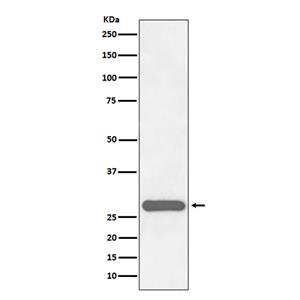 CITED2 (17H2)兔单抗,CITED2 (17H2) Rabbit Monoclonal Antibody