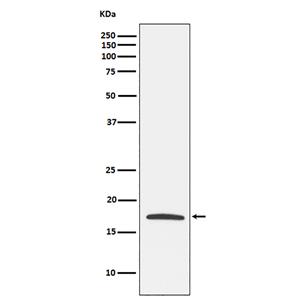Claudin 4  (6G15)兔单抗,Claudin 4  (6G15) Rabbit Monoclonal Antibody