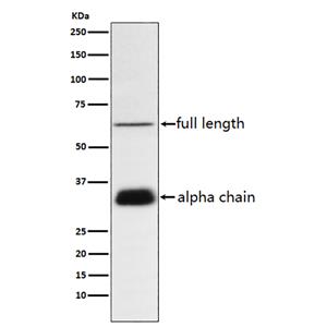Clusterin (16Y5)兔单抗,Clusterin (16Y5) Rabbit Monoclonal Antibody