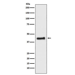 COUP TF1 (17W3)兔单抗,COUP TF1 (17W3) Rabbit Monoclonal Antibody