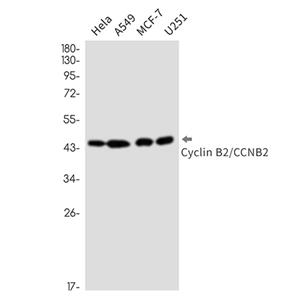 Cyclin B2 (18U13)兔单抗,Cyclin B2 (18U13) Rabbit Monoclonal Antibody