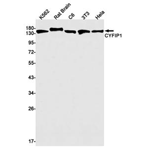 CYFIP1 (15Y6)兔单抗,CYFIP1 (15Y6) Rabbit Monoclonal Antibody