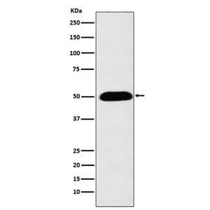 CYP27A1 (5H15)兔单抗,CYP27A1 (5H15) Rabbit Monoclonal Antibody