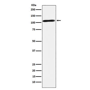 Epac2 (19F17)兔单抗,Epac2 (19F17) Rabbit Monoclonal Antibody