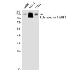 Eph receptor B1 (19N17)兔单抗,Eph receptor B1 (19N17) Rabbit Monoclonal Antibody