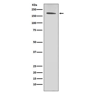 ErbB2 (HER2) (4J7)兔单抗,ErbB2 (HER2) (4J7) Rabbit Monoclonal Antibody